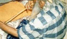 Cụ ông 102 tuổi mọc sừng trên đầu