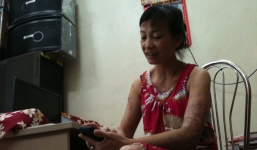 Nỗi ám ảnh chưa nguôi vụ cấm 'yêu' cô chủ 11 tuổi, tạt axit cả gia đình 5 người