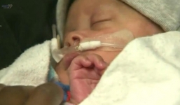 Kỳ lạ em bé chào đời vẫn nằm trong túi nước ối