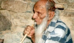 Cụ ông 102 tuổi 2 lần bị mọc sừng trên đầu