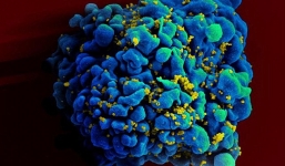 Đã tìm ra vắc xin phòng bệnh HIV?