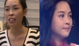 Clip quá trình phẫu thuật thẩm mỹ cô gái 'răng vẩu' thành hot girl xinh đẹp