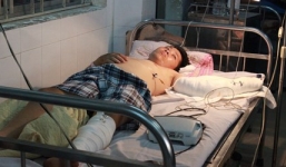 Ướp đá cánh tay bị đứt lìa mang đến bệnh viện nối