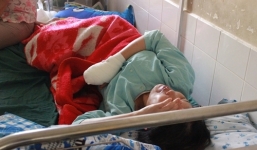 Người phụ nữ bị máy xay thịt nghiền nát 4 ngón tay