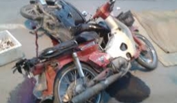 Bố say rượu khi điều khiển xe, con 3 tuổi bị que gỗ đâm vào não