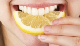 5 cách đơn giản làm sạch mảng bám, trắng răng nhanh chóng