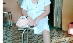 Bé trai bị cắt cụt chân do bác sĩ không tiên lượng được