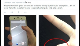 Dùng smartphone quá nhiều có thể bị biến dạng ngón út?