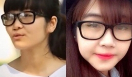 Nữ sinh Sư phạm xinh đẹp như hot girl sau phẫu thuật thẩm mỹ