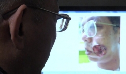 Cảnh báo: Nhai trầu cau gây ung thư miệng