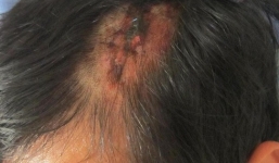 Hành khách tố nhà xe đánh chấn thương sọ não