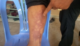 20 côn đồ lao vào nhà dân chém tán loạn và ném bom xăng