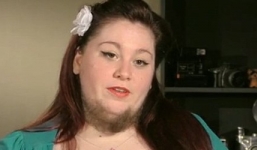 Kỳ lạ người phụ nữ mọc râu quai nón như đàn ông