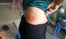 Nhóm côn đồ lao vào chém, ném bom xăng truy sát 1 gia đình