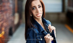 Clip cô gái 'xấu xí nhất thế giới' kể về cuộc đời mình