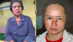 Vợ mới hành hung vợ cũ của chồng: Người trong cuộc lên tiếng