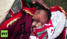 Bé gái có vòi voi trên mặt được tin là hóa thân các vị thần Hindu