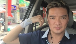 Đàm Vĩnh Hưng bị thương trước thềm liveshow khiến fan lo lắng