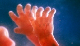 Thai nhi vỗ tay theo nhạc trong bụng mẹ 