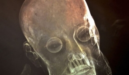 Phát hiện 8 răng người thật trong tượng Chúa Jesus 300 tuổi