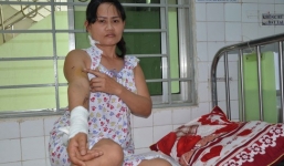 Đà Nẵng: Bé gái 9 tuổi bị thủng màng nhĩ vì xem bắn pháo hoa