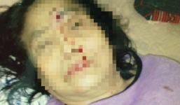 Vợ rủ chị em gái đến đánh mẹ chồng nhập viện?