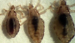 Hoảng hồn khi thấy cả trăm con chấy nhảy tanh tách trên đầu con 