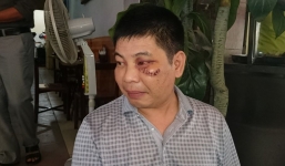 Video: Chó Pit Bull cắn đồng loại, chủ chó đánh người dã man