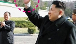 Kim Jong-un bị chấn thương cổ tay