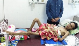 Ca sĩ Thái Lan Viên bị bệnh tàn phá chỉ còn da bọc xương