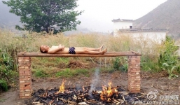 Người đàn ông nằm trên đống lửa để đốt chết tế bào ung thư