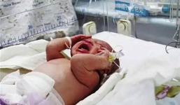 Nữ công nhân đẻ rơi con trong toilet rồi “tỉnh bơ” đi làm như thường