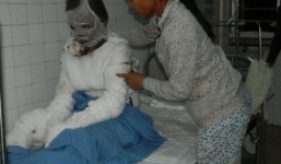 Người vợ tự thiêu trong vụ chồng bạo hành ở Quảng Ngãi đã tử vong