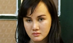 Phẫu thuật khuôn mặt trở nên xinh đẹp để trốn nã và đi lừa đảo