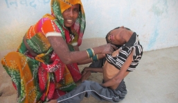 Nước mắt của gia đình bé trai mắc bệnh lạ - cổ bị gập gục 180 độ