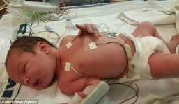 Sinh con trong lúc “chết”, mẹ hoàn toàn quên sạch chuyện mang thai