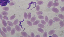 Việt Nam xuất hiện ca nhiễm trùng roi đầu tiên ở người