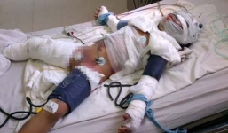 Diễn biến mới vụ cha tưới xăng lên người con gái rồi cùng tự thiêu