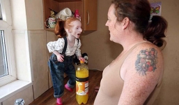 Bé gái nhỏ nhất nước Anh chỉ nặng bằng chai nước ngọt