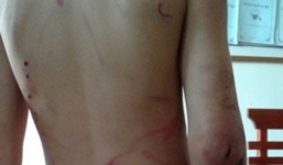 Phẫn nộ bố dùng móc sắt đánh con trai 7 tuổi vì lấy cắp tiền