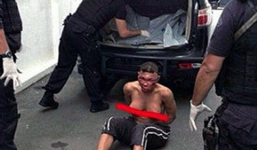 Tù nhân chuyển giới Brazil bị cảnh sát đánh “nát mặt”