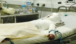 Cuộc chiến giành giật sự sống cho bé gái bị cha đốt