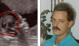 Hoảng hồn khi thấy khuôn mặt người cha đã chết trong ảnh siêu âm thai nhi