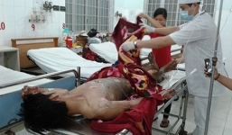 Chồng đốt vợ đúng ngày thôi nôi con, thành ra tự đốt mình