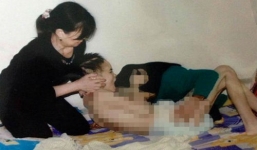 Nghi án nữ sinh 9X bị người yêu đánh đến phù não