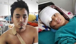 Cặp tình nhân thoát chết kỳ diệu sau khi bị rơi từ tầng tháp cao 60m