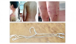 Đánh con bằng móc sắt chảy máu toàn thân rồi trói trong nhà