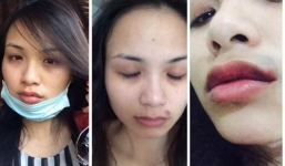 Hôn nhân đầy bi kịch của 4 mỹ nhân Việt lấy chồng đại gia