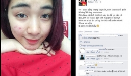 Hốt hoảng với mặt đầy mụn và vết thâm của 'người yêu' Công Phượng