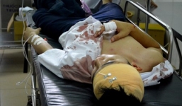 Đang chụp ảnh lưu niệm, nam sinh lớp 12 bị côn đồ chém trọng thương